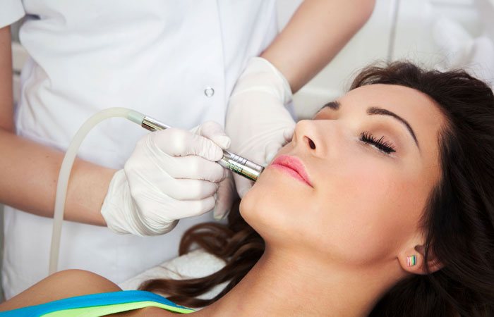 MICRODERMABRASION