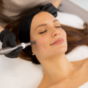Skin Needling Collagen Induction Therapy